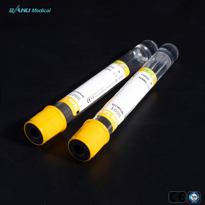4ml πλαστικός κίτρινος τοπ 1$ΟΣ σωλήνας σωλήνων συλλογής αίματος για τους προσδιορισμούς ορών