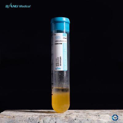 οι σωλήνες 15ml PRP ανακουφίζουν τον πόνο σωλήνες acd-PRP πηκτωμάτων διαχωριστών