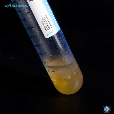 Μειώστε τον πλούσιο σωλήνα PET 50ml πλάσματος αιμοπεταλίων ανάφλεξης για την επεξεργασία OA