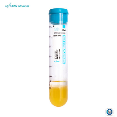 Εξάρτηση 30ml σωλήνων δοκιμής PRP